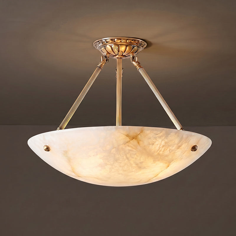 The black finish option of the pendant lamp.